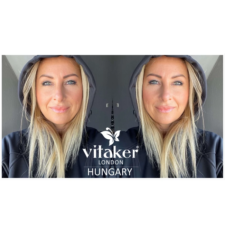ÁLDÁS VAGY ÁTOK A VÉKONYSZÁLÚ HAJ?