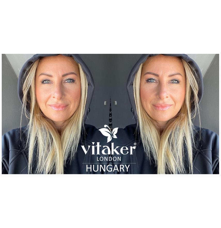 ÁLDÁS VAGY ÁTOK A VÉKONYSZÁLÚ HAJ?